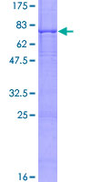 BBS1 Protein - 12.5% SDS-PAGE of human BBS1 stained with Coomassie Blue