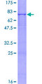 BBS1 Protein - 12.5% SDS-PAGE of human BBS1 stained with Coomassie Blue