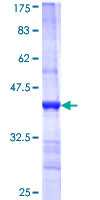 BBS1 Protein - 12.5% SDS-PAGE Stained with Coomassie Blue.