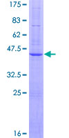 BBS10 Protein - 12.5% SDS-PAGE of human FLJ23560 stained with Coomassie Blue