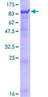 BBS12 Protein - 12.5% SDS-PAGE of human BBS12 stained with Coomassie Blue