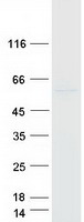 BBS4 Protein - Purified recombinant protein BBS4 was analyzed by SDS-PAGE gel and Coomassie Blue Staining