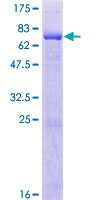 BBS5 Protein - 12.5% SDS-PAGE of human BBS5 stained with Coomassie Blue