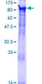 BBS7 Protein - 12.5% SDS-PAGE of human BBS7 stained with Coomassie Blue