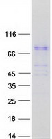BBS7 Protein - Purified recombinant protein BBS7 was analyzed by SDS-PAGE gel and Coomassie Blue Staining