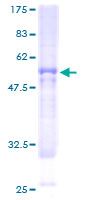 BBS9 Protein - 12.5% SDS-PAGE of human B1 stained with Coomassie Blue