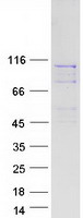 BBS9 Protein - Purified recombinant protein BBS9 was analyzed by SDS-PAGE gel and Coomassie Blue Staining