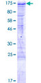 BBX Protein - 12.5% SDS-PAGE of human BBX stained with Coomassie Blue
