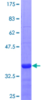 BCAM / CD239 Protein - 12.5% SDS-PAGE Stained with Coomassie Blue.