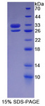 BCAM / CD239 Protein - Recombinant  Basal Cell Adhesion Molecule By SDS-PAGE