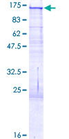 BCAN / Brevican Protein - 12.5% SDS-PAGE of human BCAN stained with Coomassie Blue