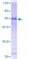 BCAP / PHF11 Protein - 12.5% SDS-PAGE of human PHF11 stained with Coomassie Blue