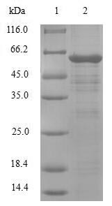 BCAP / PHF11 Protein - (Tris-Glycine gel) Discontinuous SDS-PAGE (reduced) with 5% enrichment gel and 15% separation gel.
