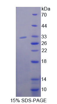 BCAP / PIK3AP1 Protein - Recombinant  Phosphoinositide-3-Kinase Adaptor Protein 1 By SDS-PAGE
