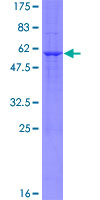 BCAP31 / BAP31 Protein - 12.5% SDS-PAGE of human BCAP31 stained with Coomassie Blue