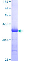BCAP31 / BAP31 Protein - 12.5% SDS-PAGE Stained with Coomassie Blue.