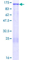 BCAR1 / p130Cas Protein - 12.5% SDS-PAGE of human BCAR1 stained with Coomassie Blue