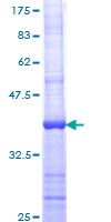 BCAR1 / p130Cas Protein - 12.5% SDS-PAGE Stained with Coomassie Blue.
