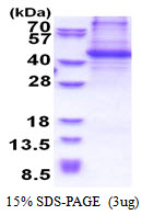 BCAR1 / p130Cas Protein