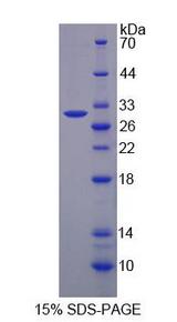 BCAR1 / p130Cas Protein - Recombinant  Breast Cancer Anti-Estrogen Resistance 1 By SDS-PAGE