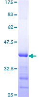 BCAR3 Protein - 12.5% SDS-PAGE Stained with Coomassie Blue.