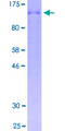 BCAS1 / NABC1 Protein - 12.5% SDS-PAGE of human BCAS1 stained with Coomassie Blue