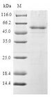 BCAS2 Protein - (Tris-Glycine gel) Discontinuous SDS-PAGE (reduced) with 5% enrichment gel and 15% separation gel.