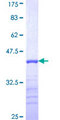 BCAS2 Protein - 12.5% SDS-PAGE Stained with Coomassie Blue