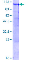 BCAS3 Protein - 12.5% SDS-PAGE of human BCAS3 stained with Coomassie Blue