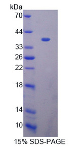 BCAS3 Protein - Recombinant  Breast Carcinoma Amplified Sequence 3 By SDS-PAGE