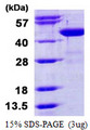 BCAT1 / ECA39 Protein