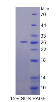 BCAT1 / ECA39 Protein - Recombinant Branched Chain Aminotransferase 1, Cytosolic (BCAT1) by SDS-PAGE