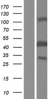 BCCIP Protein - Western validation with an anti-DDK antibody * L: Control HEK293 lysate R: Over-expression lysate