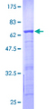 BCCIP Protein - 12.5% SDS-PAGE of human BCCIP stained with Coomassie Blue