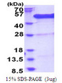 BCCIP Protein