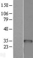 BCDIN3D Protein - Western validation with an anti-DDK antibody * L: Control HEK293 lysate R: Over-expression lysate