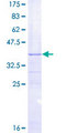 BCHE / Cholinesterase Protein - 12.5% SDS-PAGE Stained with Coomassie Blue.