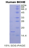 BCHE / Cholinesterase Protein - Recombinant Butyrylcholinesterase By SDS-PAGE