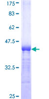 BCKDHA / BCKDE1A Protein - 12.5% SDS-PAGE Stained with Coomassie Blue.