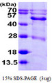 BCKDHA / BCKDE1A Protein