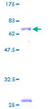 BCKDHB Protein - 12.5% SDS-PAGE of human BCKDHB stained with Coomassie Blue