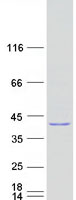 BCKDHB Protein - Purified recombinant protein BCKDHB was analyzed by SDS-PAGE gel and Coomassie Blue Staining