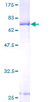 BCKDK Protein - 12.5% SDS-PAGE of human BCKDK stained with Coomassie Blue