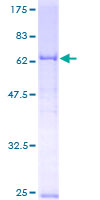 BCKDK Protein - 12.5% SDS-PAGE of human BCKDK stained with Coomassie Blue