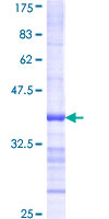 BCKDK Protein - 12.5% SDS-PAGE Stained with Coomassie Blue.