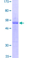 BCL10 / BCL-10 Protein - 12.5% SDS-PAGE of human BCL10 stained with Coomassie Blue