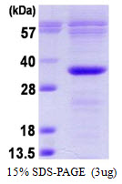 BCL10 / BCL-10 Protein