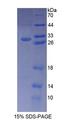 BCL10 / BCL-10 Protein - Recombinant  B-Cell CLL/Lymphoma 10 By SDS-PAGE
