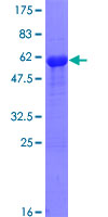 BCL11A Protein - 12.5% SDS-PAGE of human BCL11A stained with Coomassie Blue