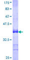 BCL11A Protein - 12.5% SDS-PAGE Stained with Coomassie Blue.